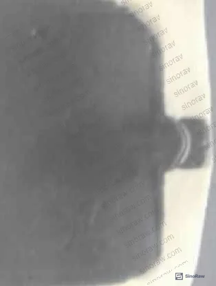 Figure 4: Cross-sectional portrait view of PTFE-coated NBR5080 showing the double-sided film laminate structure